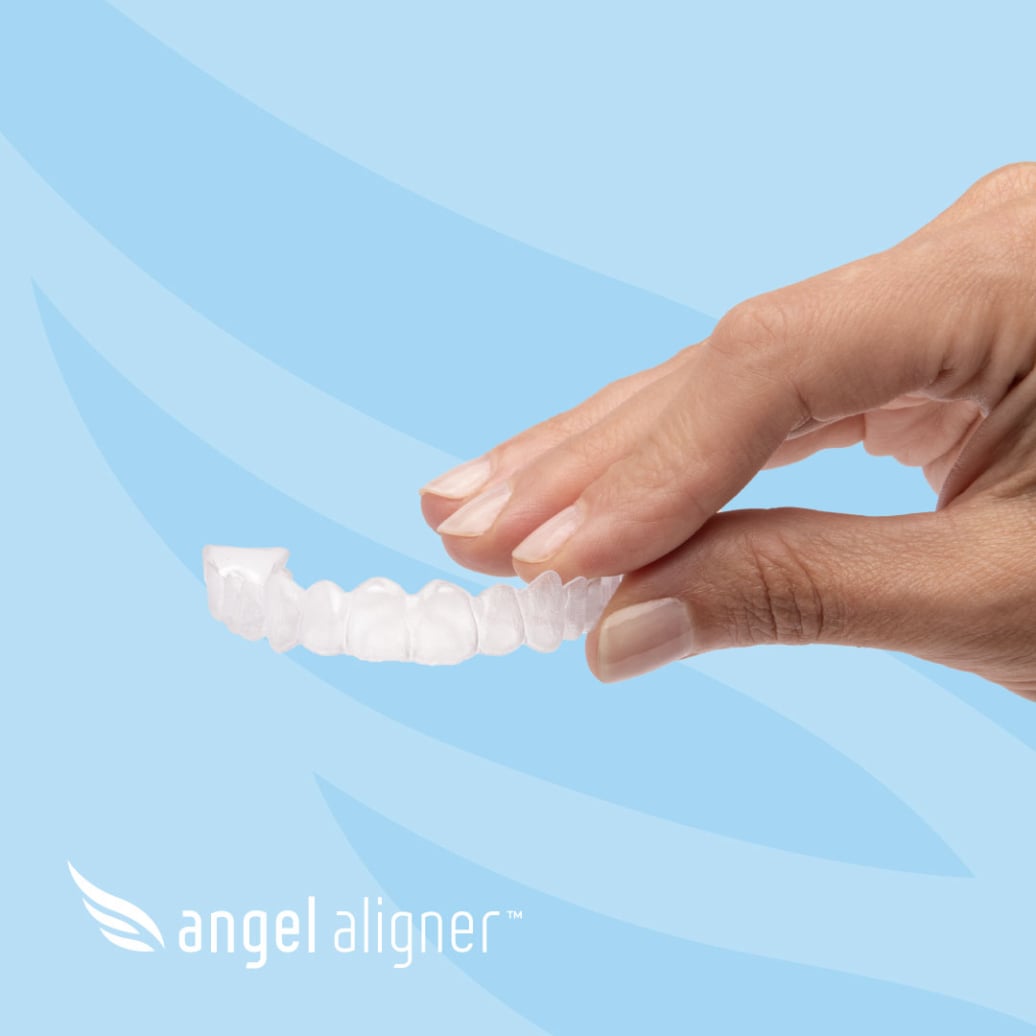 Angel Aligner clear aligners at Root Cause Dental Group