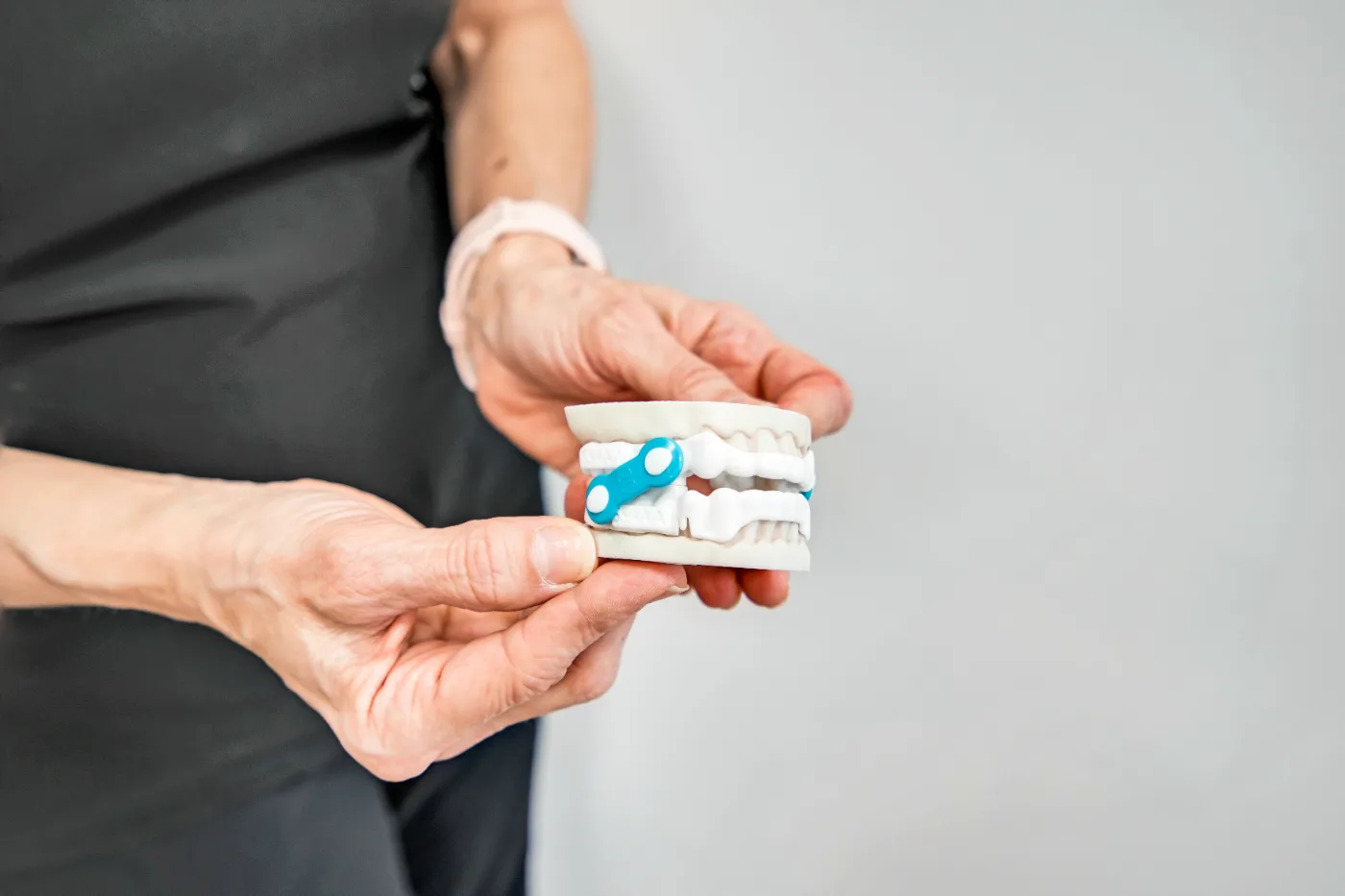 SERENA sleep appliance shown on a dental model, with the blue advancement connector